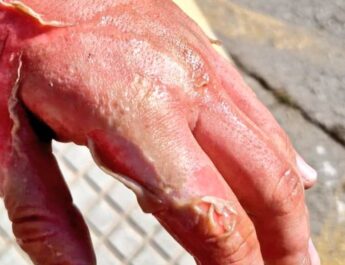 El incendio de una sartén con aceite en Tomares alerta sobre un error doméstico muy peligroso