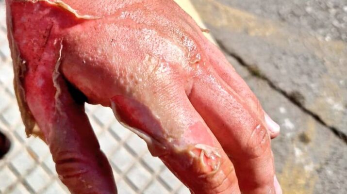 El incendio de una sartén con aceite en Tomares alerta sobre un error doméstico muy peligroso